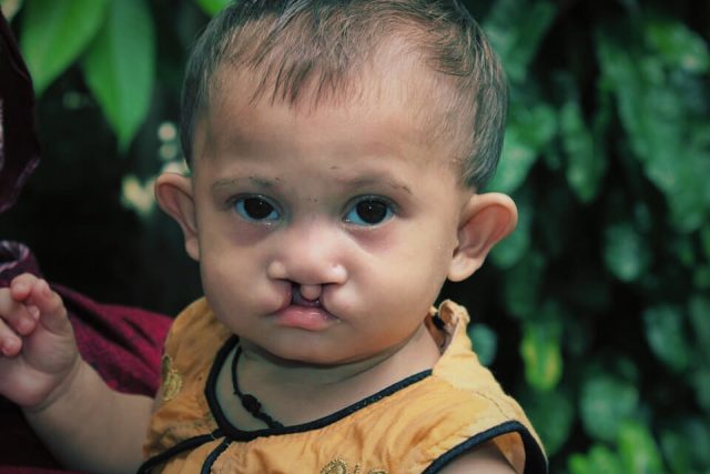 cleft bangladesh non-profit organization bangladesh