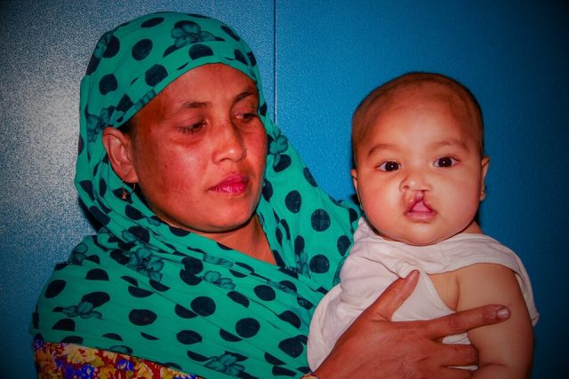 Smile Train Ibn Sina Hospital Cleft Project non-profit organization bangladesh