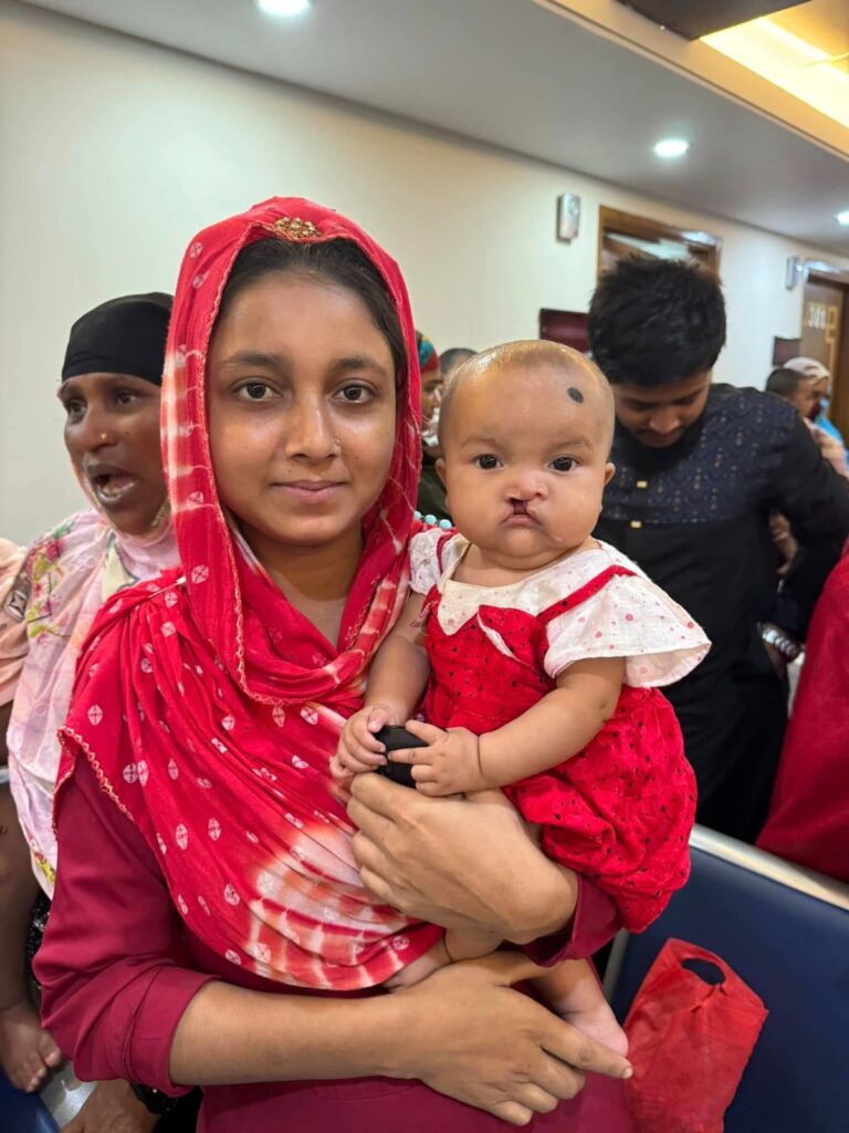feeding milk to cleft lip children