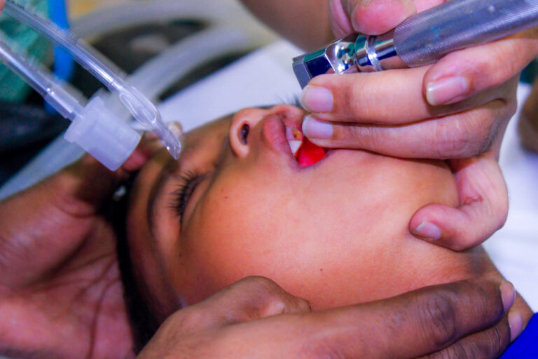 free cleft operation in Bangladesh