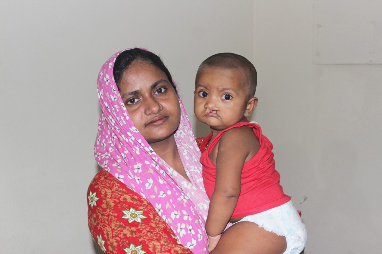 তালু কাটা রোগের চিকিৎসা: সম্পূর্ণ গাইড